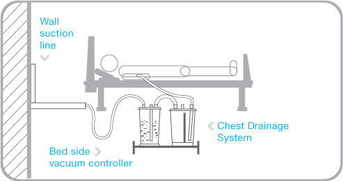 Bedside Vacuum Controller